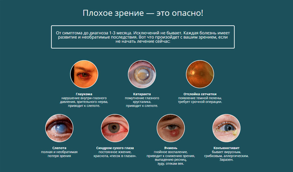 Зрение в 1 месяц. Причины ухудшения зрения. Симптомы плохого зрения.